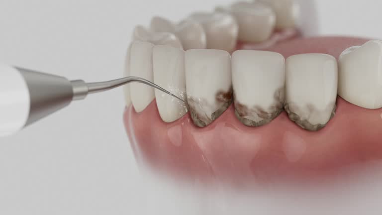 Trusted Emergency Dentist service in Severna Park, MD - Dentist Open Now